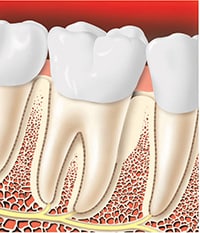 ad26 1