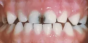 ad28